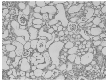 Seriál Úvod do aktivních folátových nečistot: ① Odhalení dopadu kyseliny 5-methyltetrahydropterové.